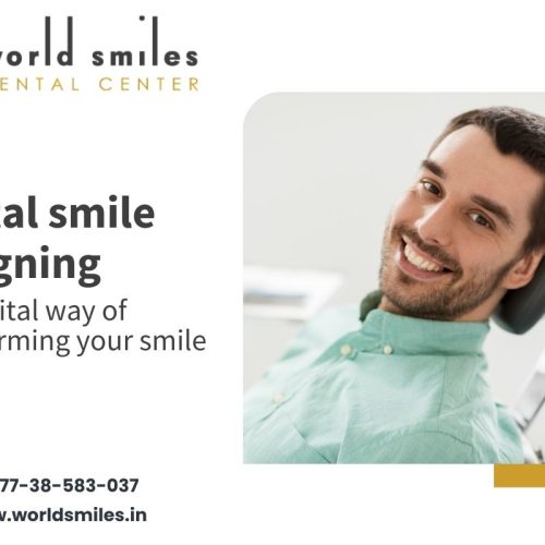 Design your smile digitally - Digital Smile Designing in Parel