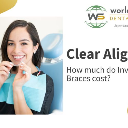 Clear Aligners Cost in Parel