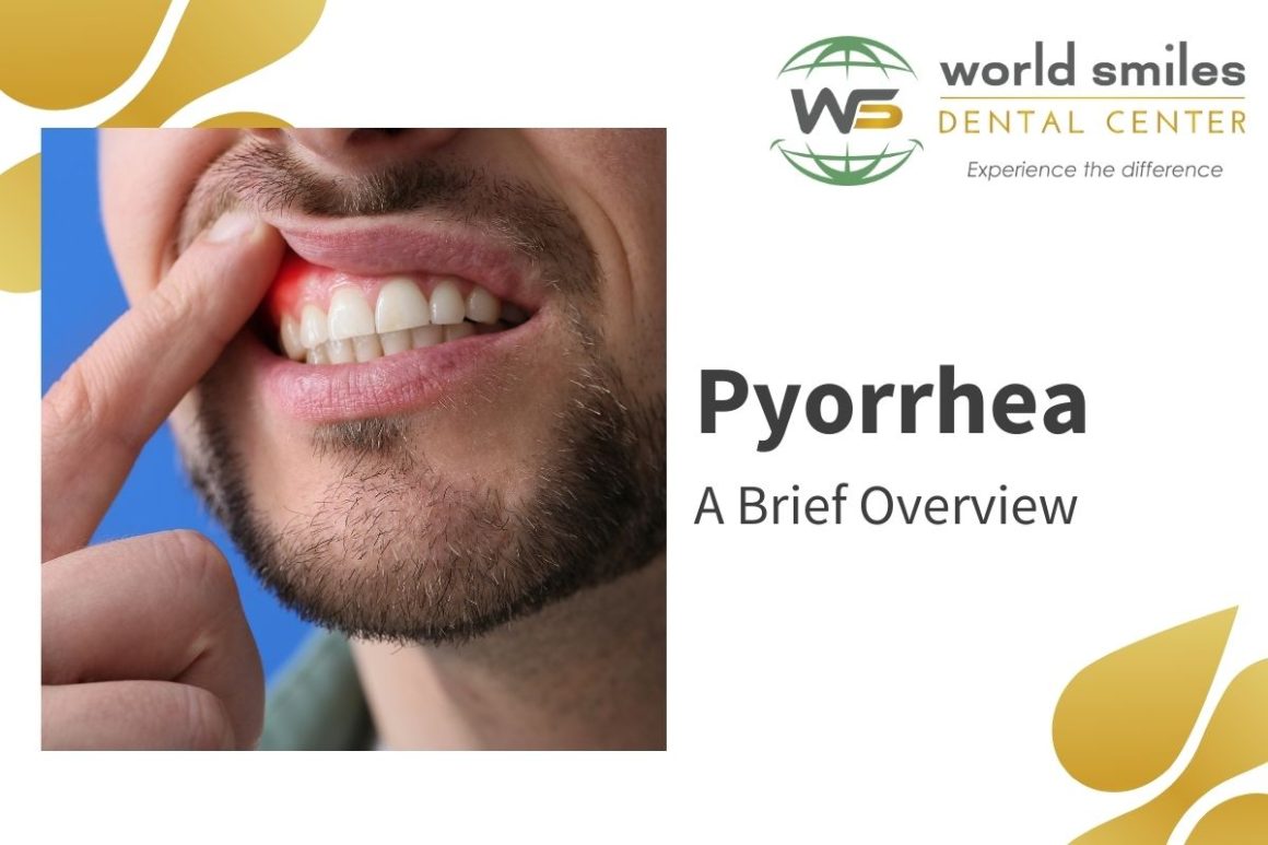 What is pyorrhea